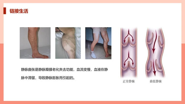 血流的管道，血管课件PPT模板.ppt