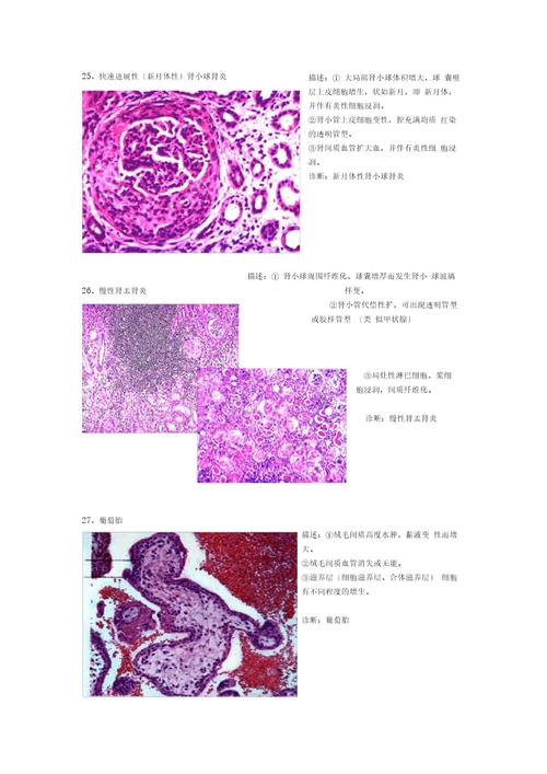 病理切片整理