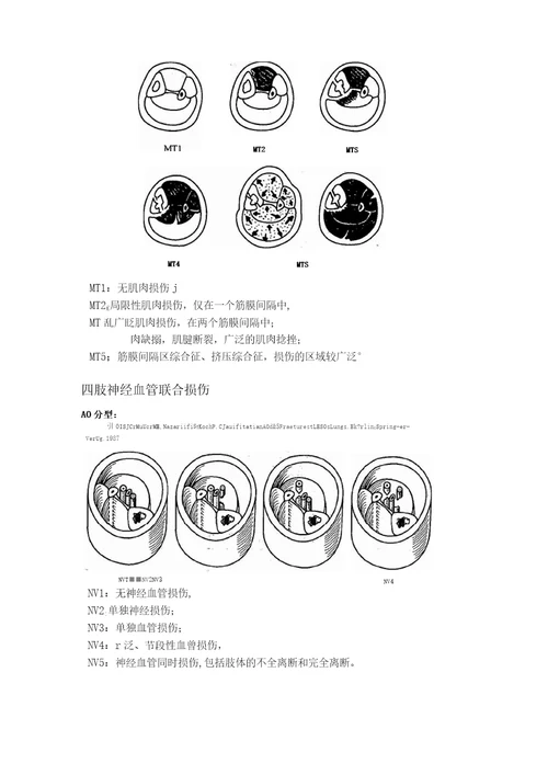 软组织损伤诊断分型标准