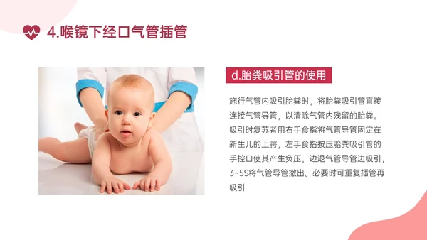 红色实拍新生儿心肺复苏