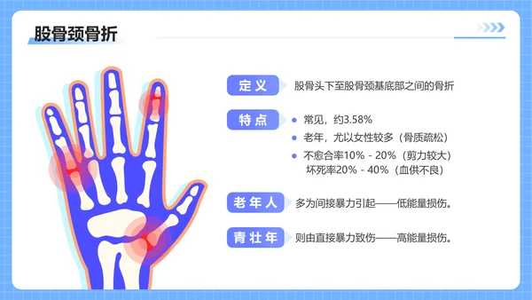 蓝色插画风股骨颈骨医护人员培训讲座医学护理PPT