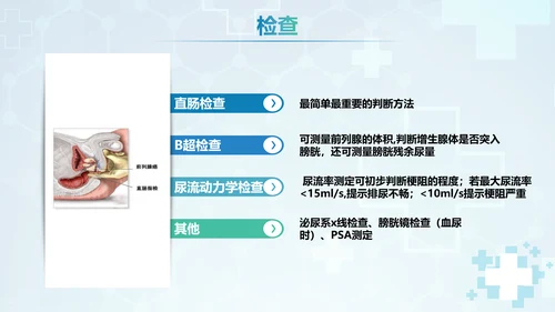 前列腺增生术后康复护理PPT模板