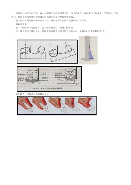 口腔主治医师考试专业实践能力口腔修复学牙列缺损修复