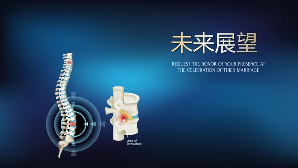 蓝色医疗颈椎病的护理动态PPT