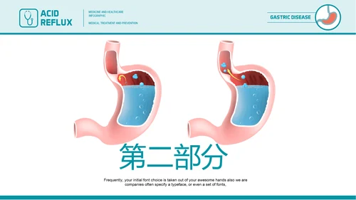医疗医学胃肠道消化ppt课件动态模板