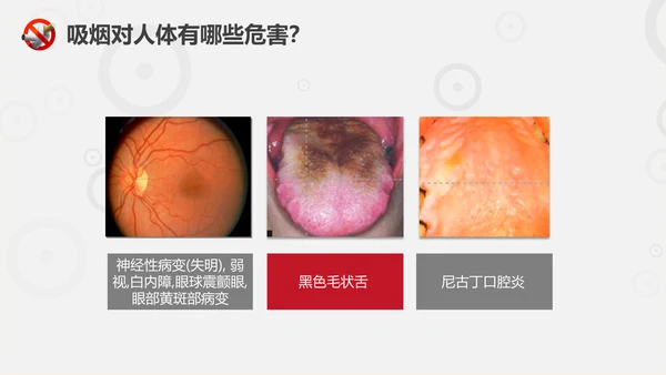 珍爱生命远离香烟世界无烟日通用PPT