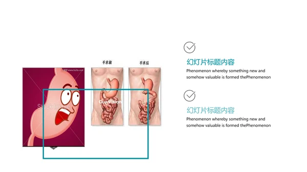 医疗医学胃肠道消化ppt课件动态模板