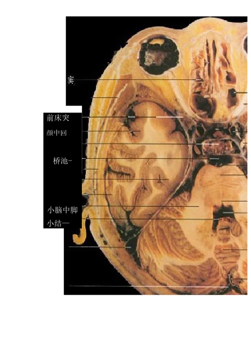 中枢神经系统断层影像