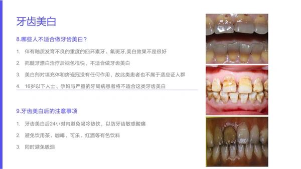 中青年口腔卫生牙料知识宣教PPT模板