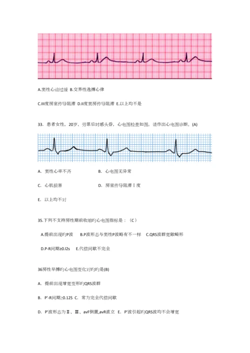 2023年规培心电图题库.docx