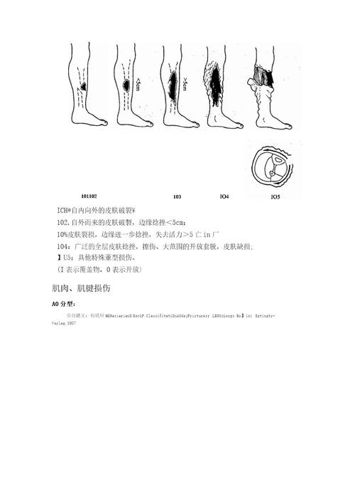 软组织损伤诊断分型标准