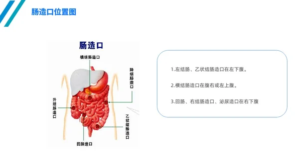 简约风线条风商务风肠造口护理医学护士培训PPT课件护理查房