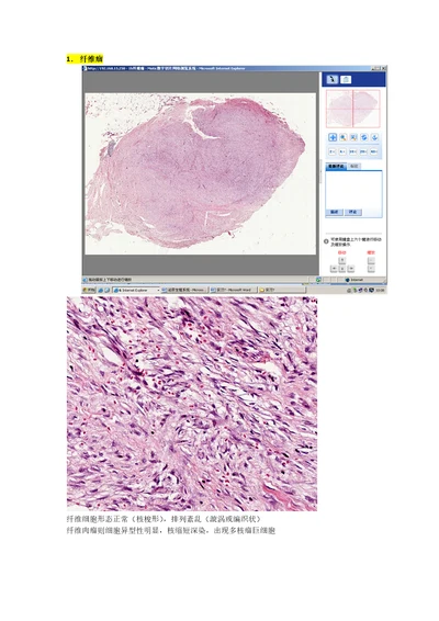 病理学各论切片：泌尿生殖系统