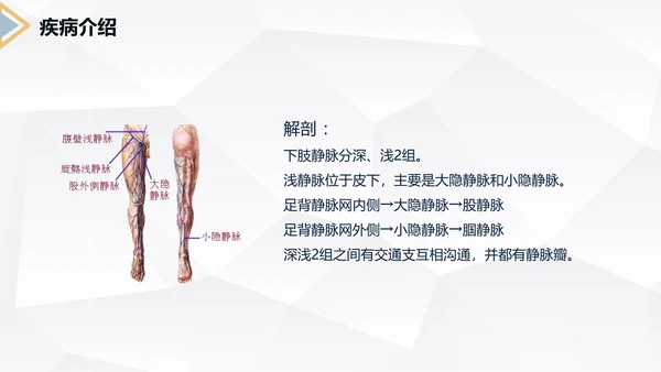 下肢静脉曲张护理查房医疗教学PPT课件