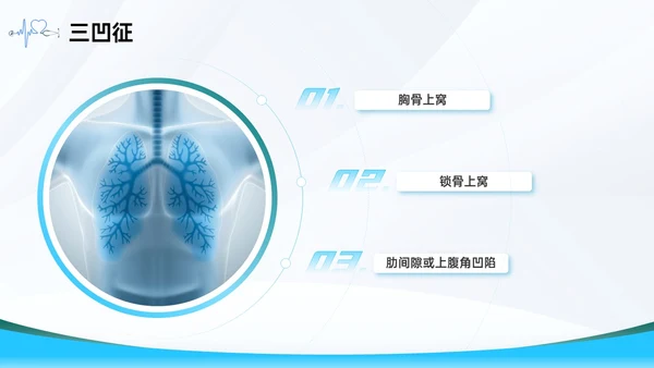 蓝色简约医疗护理主题呼吸困难的护理课件PPT呼吸衰竭
