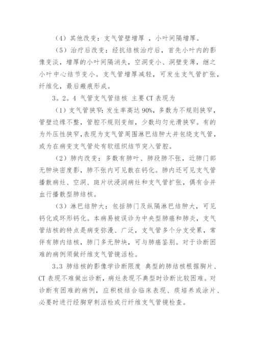 肺结核护理毕业论文.docx