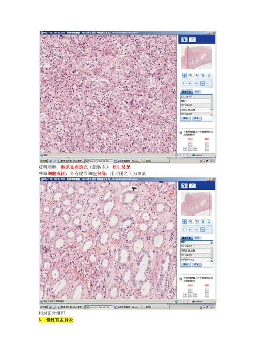 病理学各论切片：泌尿生殖系统