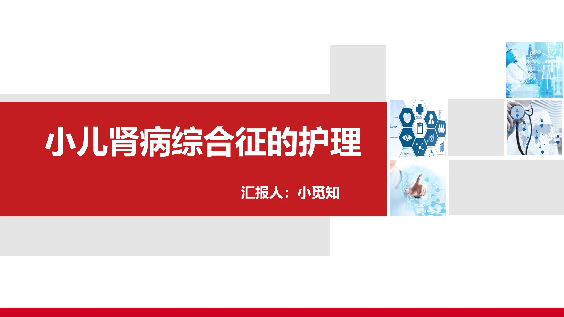 红色扁平肾病综合征护理查房小儿肾病综合征的护理PPT模板