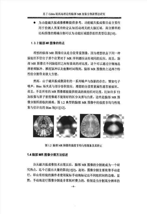 基于Gibbs随机场理论的脑部MR图像分割新算法研究生物医学工程专业论文