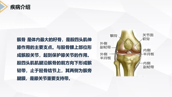 髌骨骨折术后护理知识教学PPT课件
