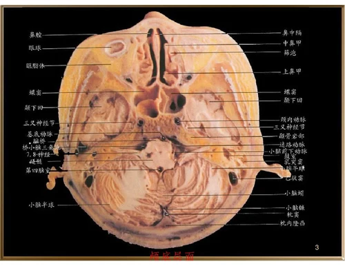 中枢神经系统断层影像