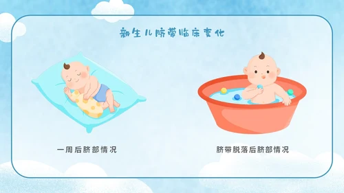 蓝色手绘卡通新生儿护理新生儿脐部护理主题PPT模板