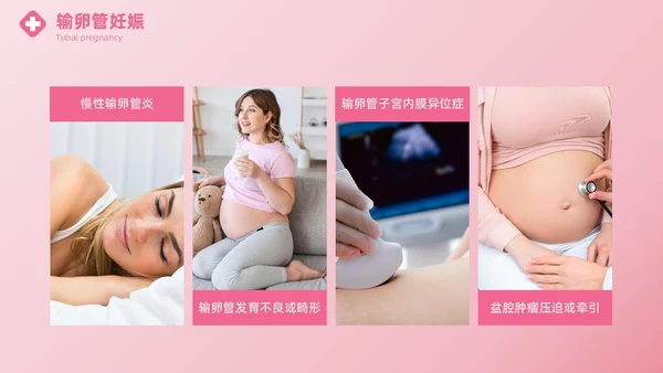 粉色实拍风异位妊娠的诊治医疗健康母婴孕妇培训PPT