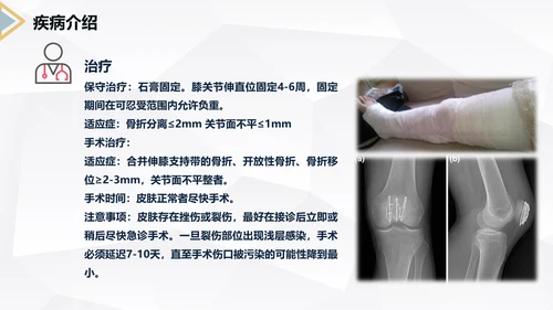 髌骨骨折术后护理知识教学PPT课件