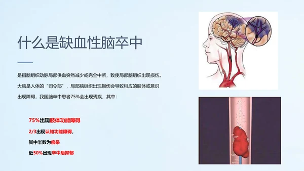远离疾病预防高血压健康专题讲座PPT课件