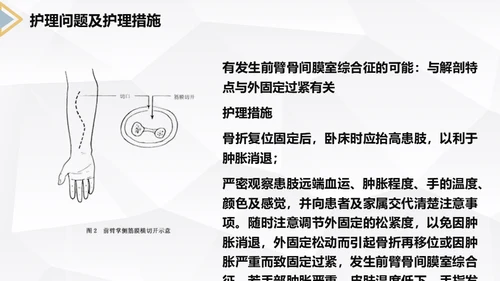 左桡尺骨双骨折护理查房通用PPT模板