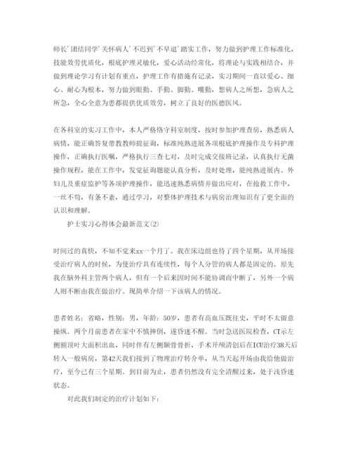 精编护士实习参考心得体会参考范文5篇（通用）.docx