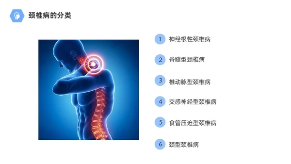 商务风蓝色颈椎病的护理查房颈椎间盘退变医学培训PPT