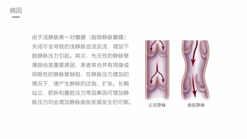 下肢静脉曲张护理专业教学PPT课件
