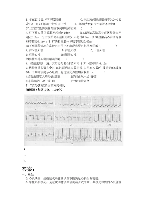 心电图出科考试题及答案