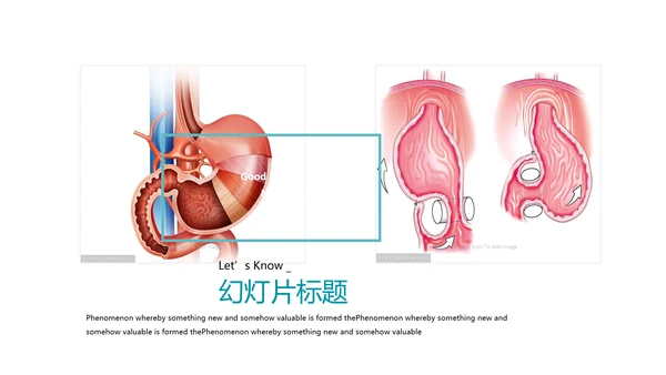 医疗医学胃肠道消化ppt课件动态模板