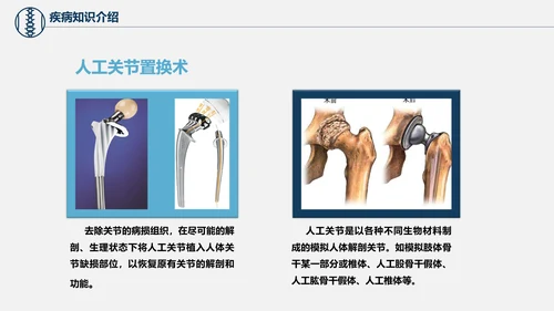 股骨颈骨折术后护理查房培训教学PPT课件
