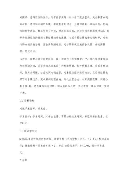 改良右半结肠切除术在结肠癌患者治疗中的优势观察.docx