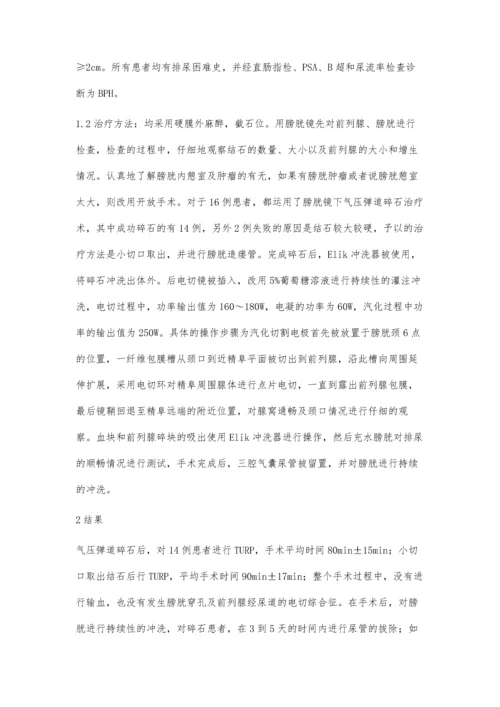 手术治疗前列腺增生症合并膀胱结石的临床观察.docx