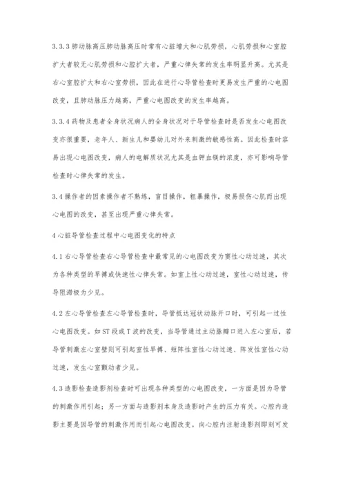 心脏导管检查过程中的心电图变化.docx