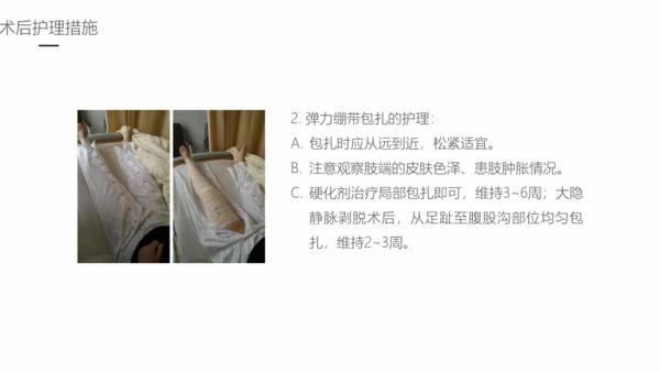 下肢静脉曲张护理专业教学PPT课件