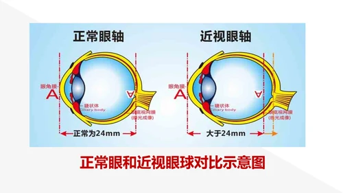 保护视力预防近视PPT