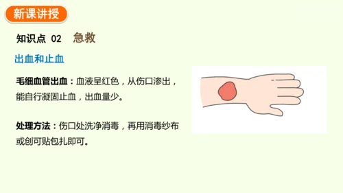 8.2用药与急救-八年级生物人教版下学期同步精品课件(共38张PPT)