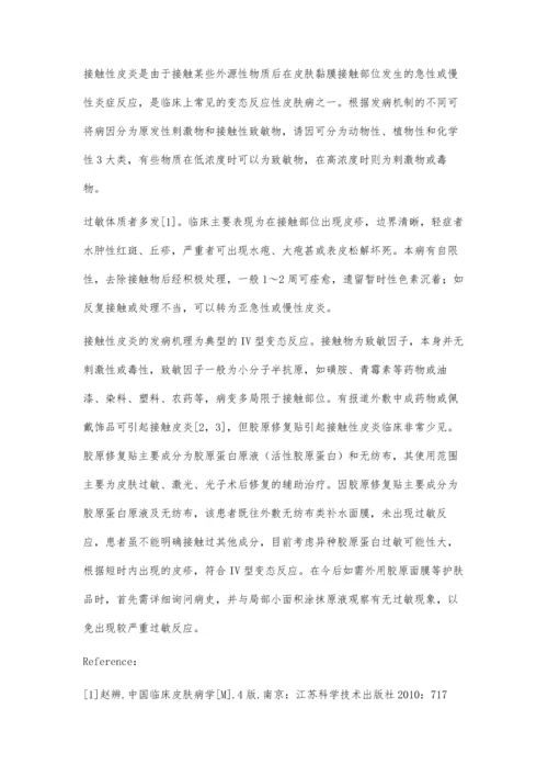 胶原修复贴致接触性皮炎一例.docx