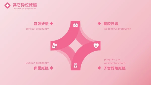 粉色实拍风异位妊娠的诊治医疗健康母婴孕妇培训PPT
