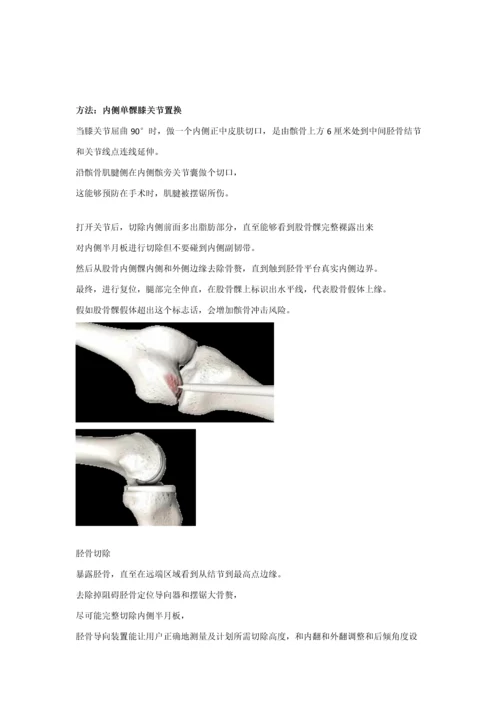 SLED单髁新器械操作基础手册非最终版.docx