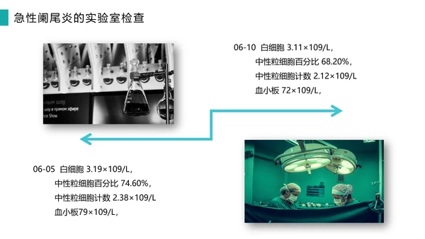 急性阑尾炎护理查房医院病例PPT模板