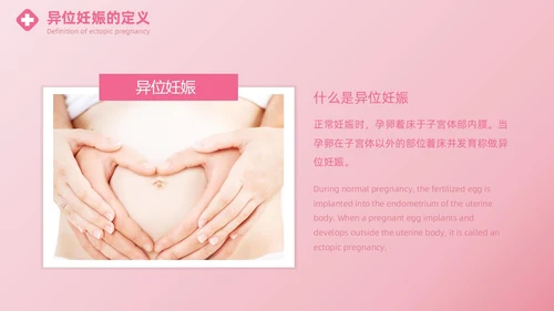 粉色实拍风异位妊娠的诊治医疗健康母婴孕妇培训PPT