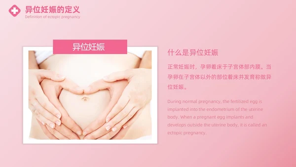 粉色实拍风异位妊娠的诊治医疗健康母婴孕妇培训PPT