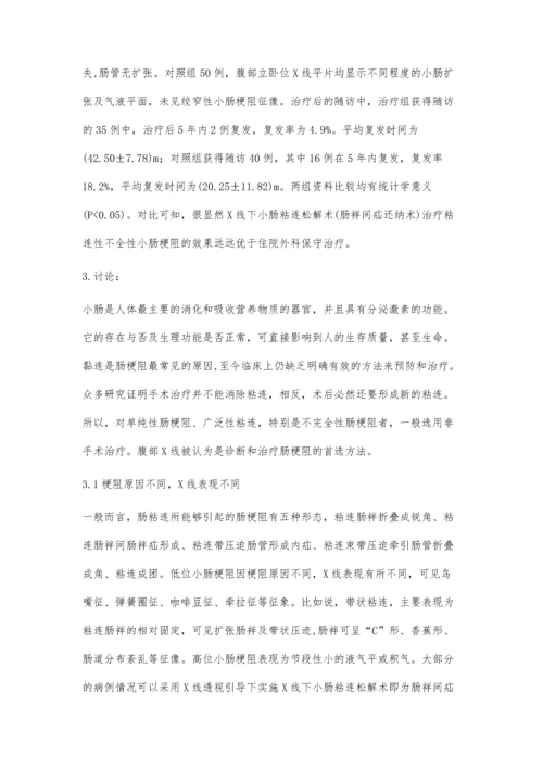 分析X线下黏连性不全性小肠梗阻的临床疗效.docx