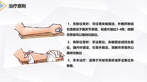 左桡尺骨双骨折护理查房通用PPT模板